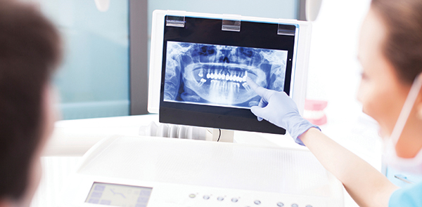Baton Rouge LA Dentist showing a patient Dental X-Ray