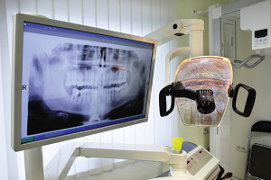 Digital Dental X-Ray at Baton Rouge LA dentist