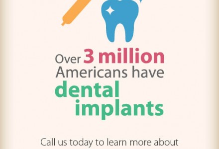 Dental Implants Facts