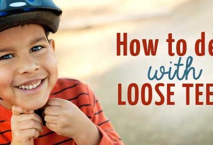How to deal with loose teeth